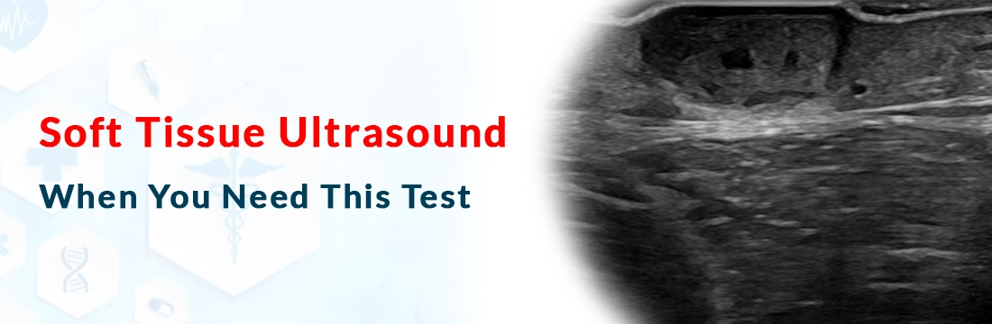 Soft Tissue Ultrasound: When You Need This Test